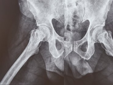 Dlaczego boli miednica i kiedy należy udać się do lekarza z tą dolegliwością?