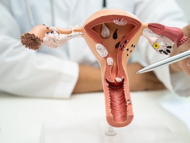 Histeroskopia - czym jest, na czym polega, wskazania, czym różni się od łyżeczkowania?