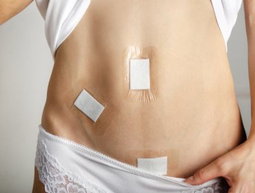 Laparoskopia jajnika