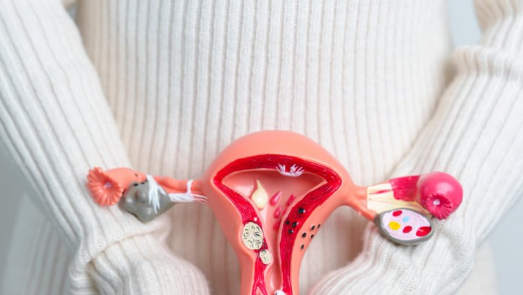 Obfita miesiączka po łyżeczkowaniu macicy – co jest normą, a co wymaga kontroli u ginekologa?