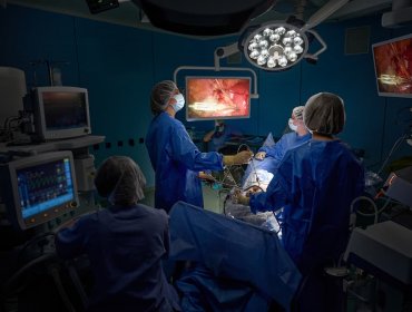 Usuwanie mięśniaków macicy przez pochwę, metodą VNotes