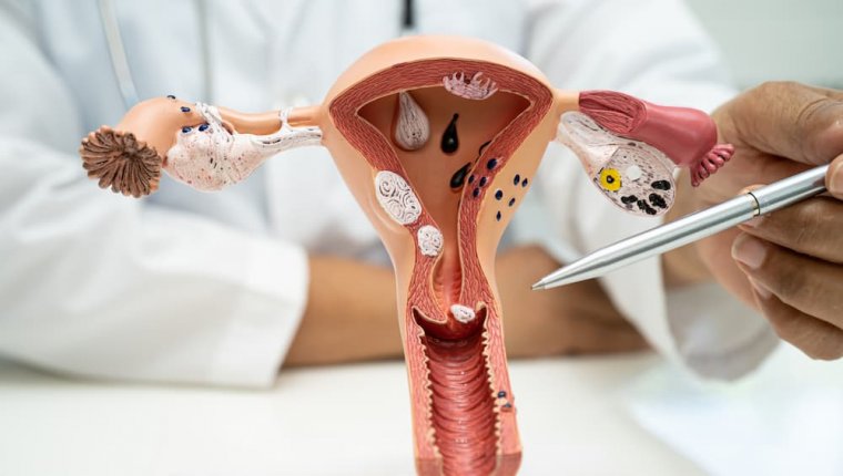 Histeroskopia – czym jest, na czym polega, wskazania, czym różni się od łyżeczkowania?